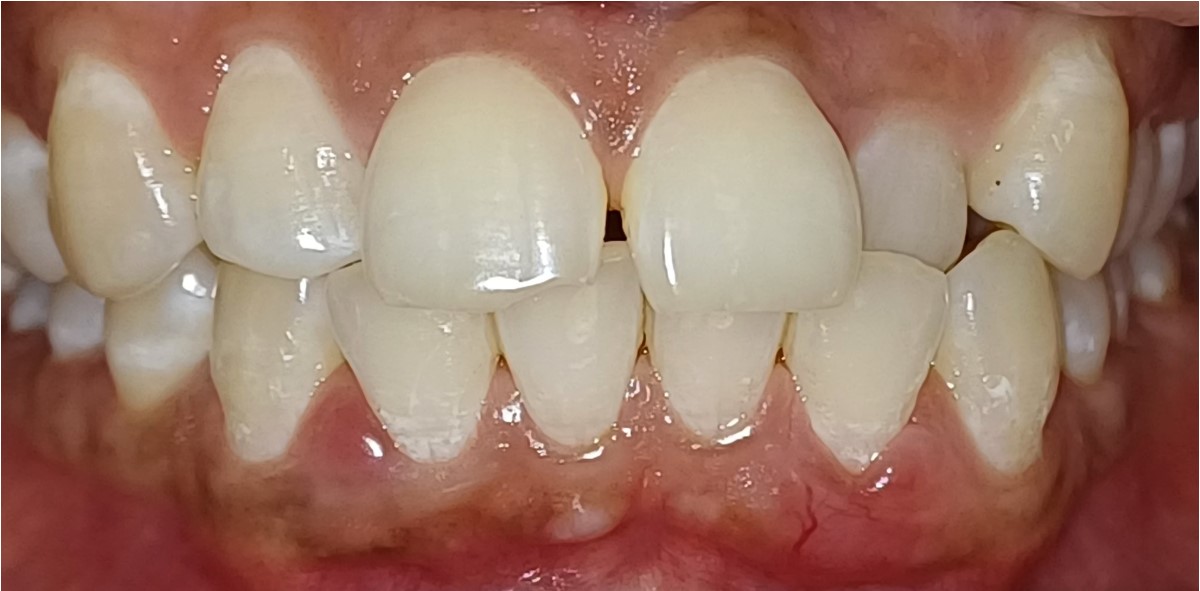 Before Image